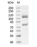 Complement C5 Protein, Human, Recombinant (His & FLAG)