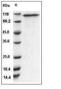 CD93/C1qR1 Protein, Human, Recombinant (His)