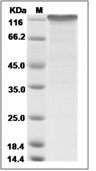 Notch 1 Protein, Human, Recombinant (hFc)