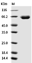 Influenza A H1N1 (A/Brisbane/02/2018) Neuraminidase/NA Protein (His)