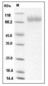 Influenza A H3N2 (A/Babol/36/2005) Neuraminidase/NA Protein (His)