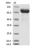 Influenza A H1N1 (A/California/04/2009) Hemagglutinin/HA Protein ( (Native, HA1+HA2, uncleaved),His)