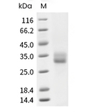 4-1BB/CD137/TNFRSF9 Protein, Human, Recombinant (His)