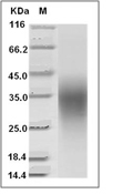 CD79B Protein, Human, Recombinant (His)
