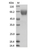 AXL Protein, Human, Recombinant (His)