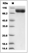 IL-18R beta/IL-18RAP Protein, Rhesus, Recombinant (hFc)