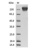 VEGFR2/KDR Protein, Human, Recombinant (His)