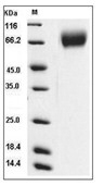TrkB Protein, Mouse, Recombinant (His)