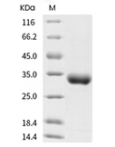 CD122/IL2RB Protein, Human, Recombinant (His)