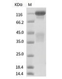 Insulin Receptor Protein, Human, Recombinant (long isoform, His)