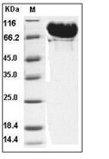 MMP-9 Protein, Human, Recombinant (His)