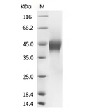IL-7R alpha/CD127 Protein, Human, Recombinant (His)