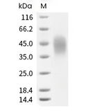 CD16b Protein, Human, Recombinant (NA2, CHO, His)