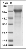 Influenza A H1N1 (A/Michigan/45/2015) Neuraminidase/NA (His)