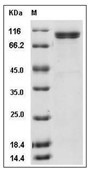 Thyroid peroxidase Protein, Human, Recombinant (S257A & P725T, His)