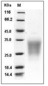SIGIRR Protein, Human, Recombinant (His)