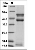 Latent TGF beta 2 Protein, Mouse, Recombinant (His)