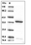 HtrA2/Omi Protein, Human, Recombinant (His)