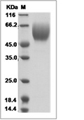 DcR1/TRAILR3 Protein, Human, Recombinant (His)