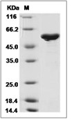 Influenza A H7N9 (A/Shanghai/2/2013) Nucleoprotein/NP Protein (His)