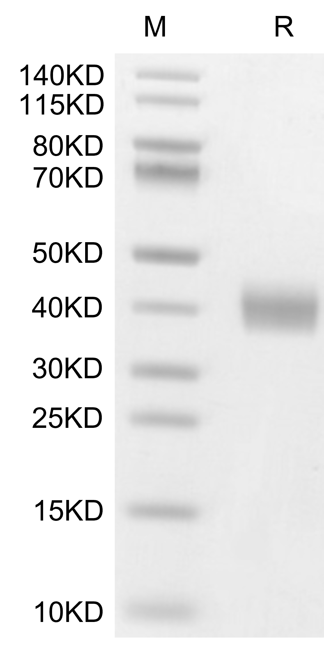 Galectin-3/LGALS3 Protein, Human, Recombinant (His)