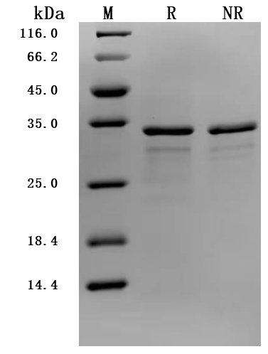 ODAM Protein, Human, Recombinant (His)