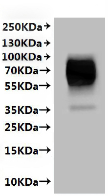 SLC10A1 Protein-VLP, Human, Recombinant (His)