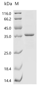 CDK1 Protein, Human, Recombinant (His)