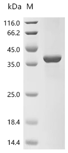 SULT1A1 Protein, Mouse, Recombinant (His & Myc)