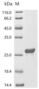 MMP-1 Protein, Human, Recombinant (E. coli, His)