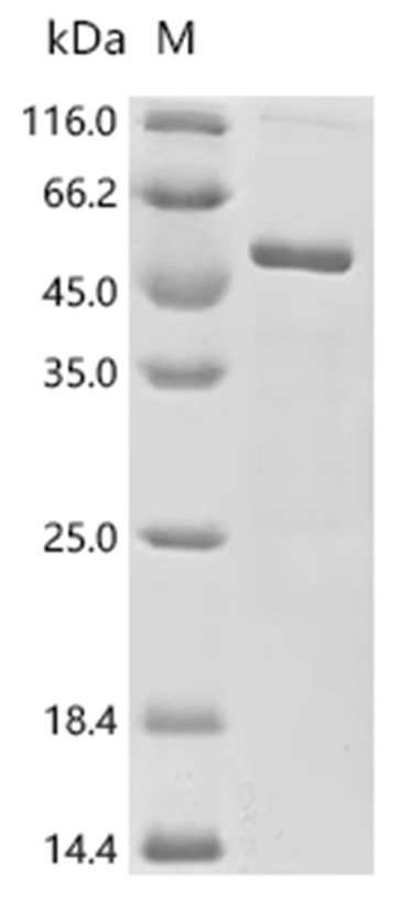 LATS1 Protein, Human, Recombinant (His & Myc)