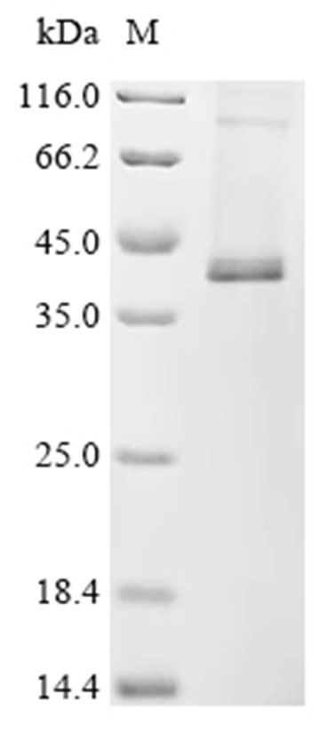 CB2/CNR2 Protein, Human, Recombinant (His)