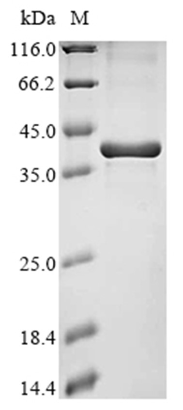 Ribonuclease H1 Protein, Human, Recombinant (His)
