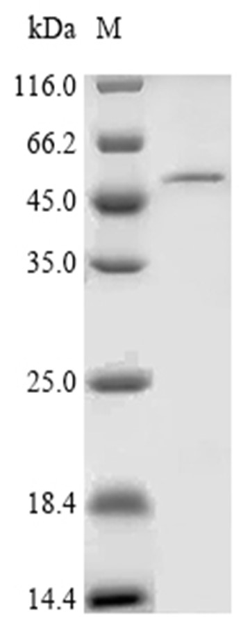 Elastase Protein, Pseudomonas aeruginosa, Recombinant (His & SUMO)