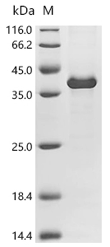 ICAM4 Protein, Mouse, Recombinant (His & SUMO)