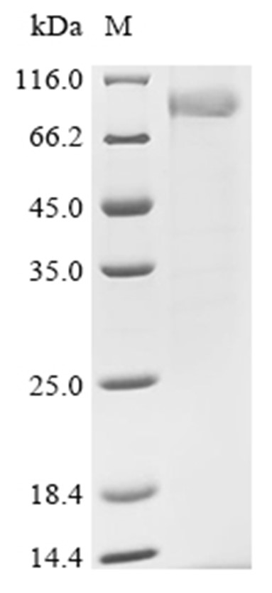 BTK Protein, Human, Recombinant (His)