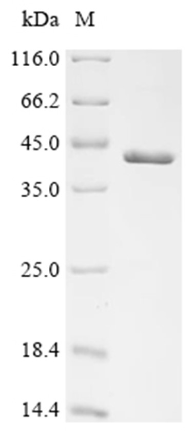 Cathepsin Z Protein, Rat, Recombinant (His & SUMO)