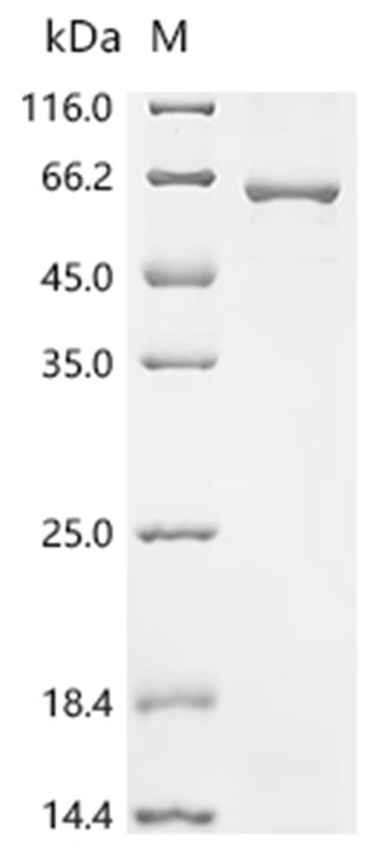 Lck Protein, Human, Recombinant (His)