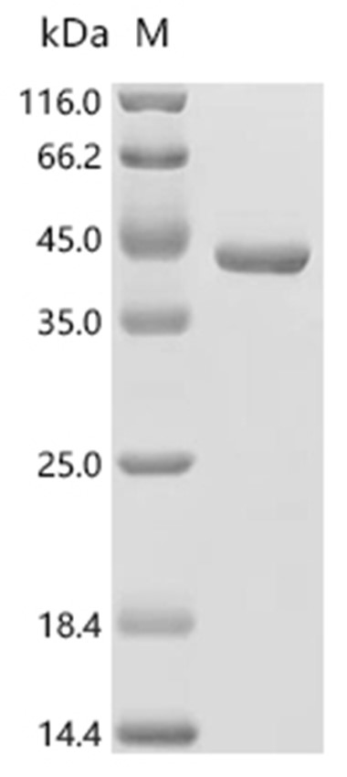 SDS Protein, Human, Recombinant (His & Myc)