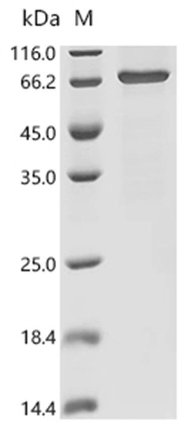 FOXC1 Protein, Human, Recombinant (His)