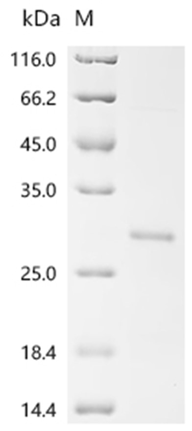 Human Papilloma Virus type 16 (HPV 16) Protein E6 (E. coli, His)