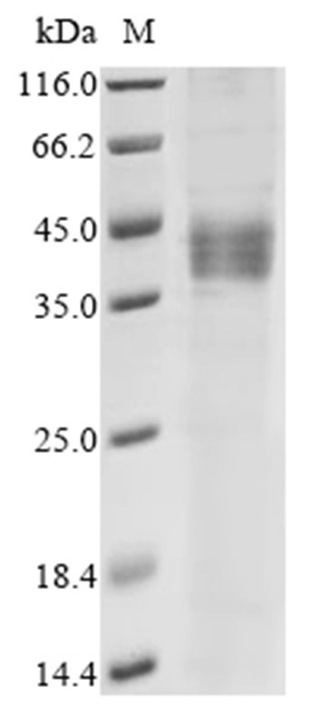 STRA6 Protein, Human, Recombinant (hFc)