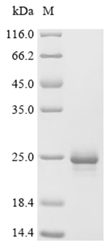 C1QA Protein, Mouse, Recombinant (His)