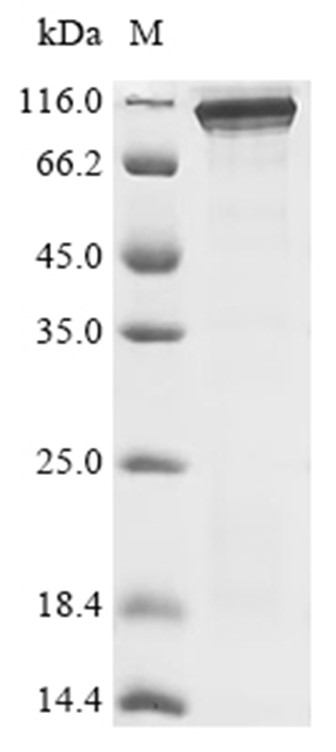 Nucleolin Protein, Human, Recombinant (His)