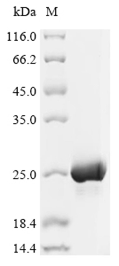 WISP2/CCN5 Protein, Mouse, Recombinant (His)