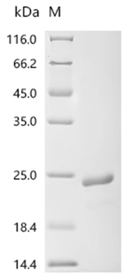APOC1 Protein, Human, Recombinant (His & SUMO)