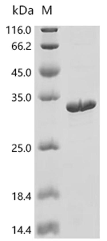 PPARD Protein, Human, Recombinant (His)