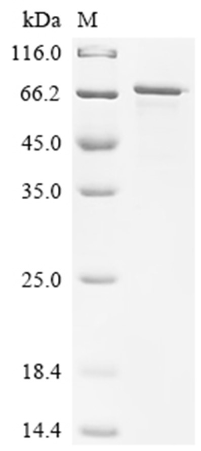 MMP-14 Protein, Human, Recombinant (His & SUMO)