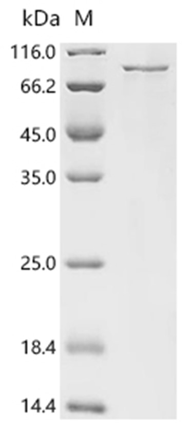 DNM1L Protein, Human, Recombinant (His & Myc)