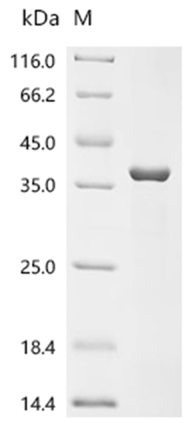 ANXA3 Protein, Human, Recombinant (His)